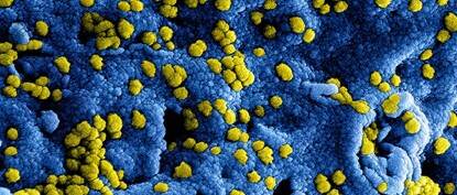 Coronavirus © National Institute of Allergy and Infectious Diseases (NIAID)