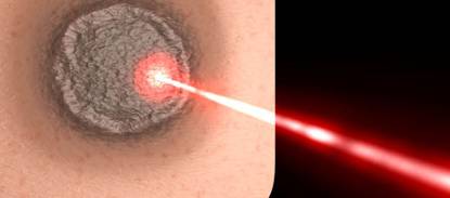 Optische straling